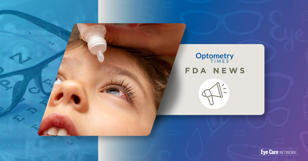 Eye drop administered to child Image credit: AdobeStock/vitalis83