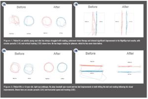 4 ways to use eye tracking in your practice 