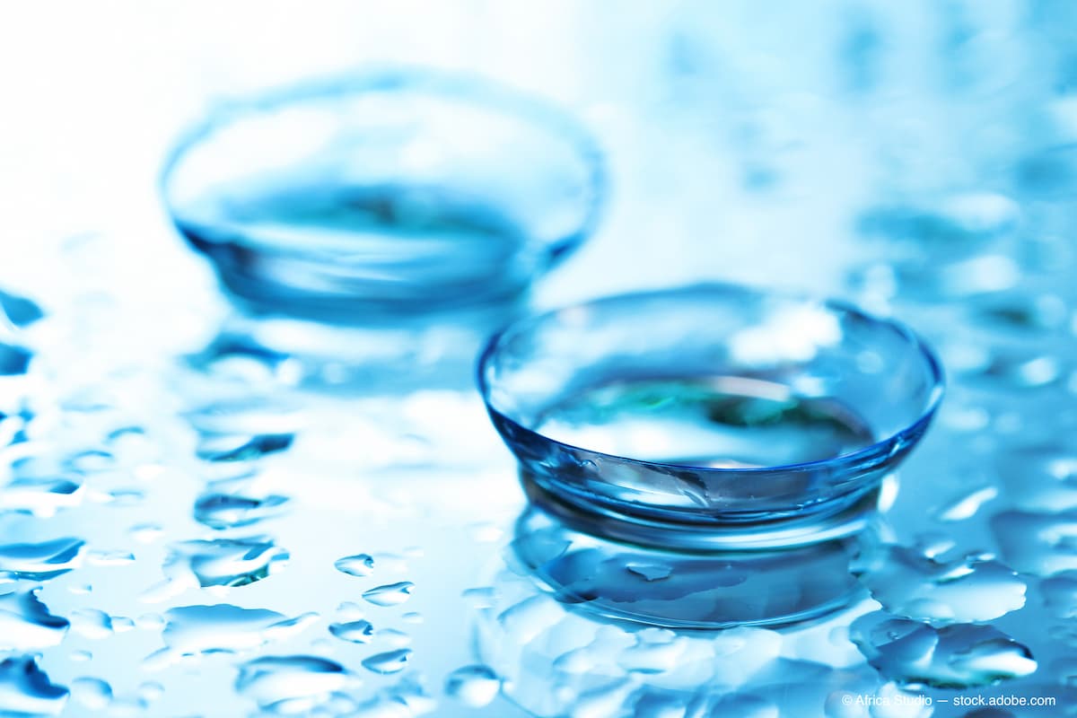 contact lens with drops on blue background (Adobe Stock / Africa Studio)