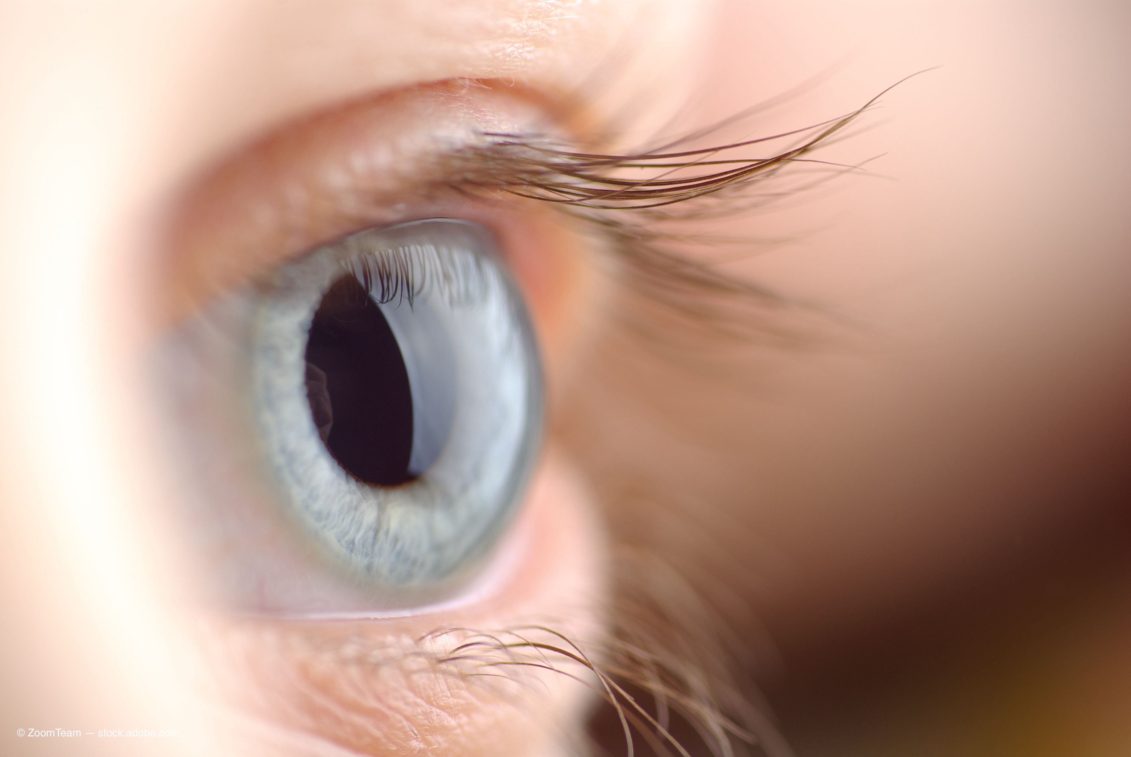 Glaukos lanza el programa clínico de salud corneal de fase 2 para la terapia iLink