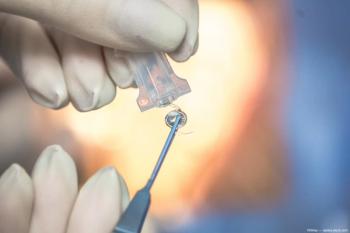 Intraocular lens taken out of injector Image credit: ©Oktay - adobe.stock.com