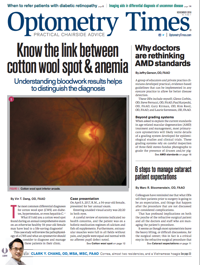 Cotton Wool Spots in a Patient with COVID-19  Published in CRO (Clinical &  Refractive Optometry) Journal