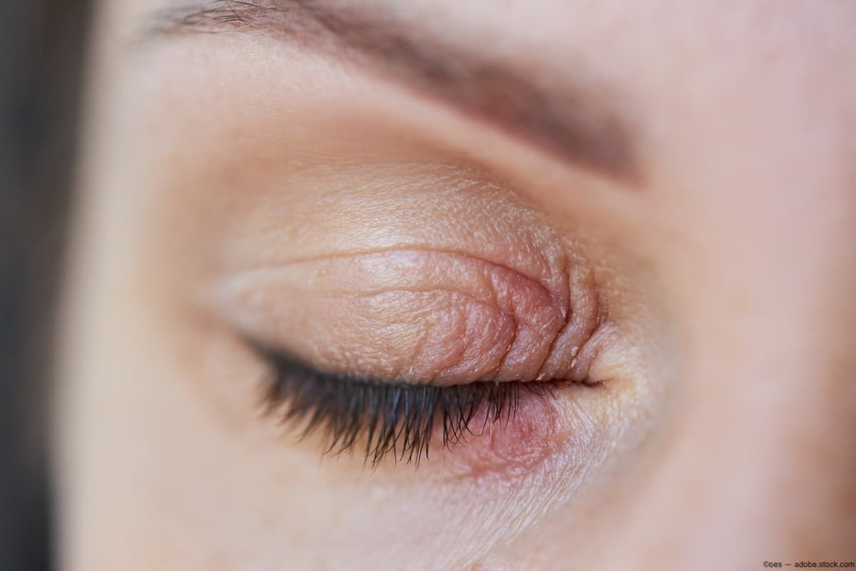 Closeup of closed eyelid Image credit: AdobeStock/oes