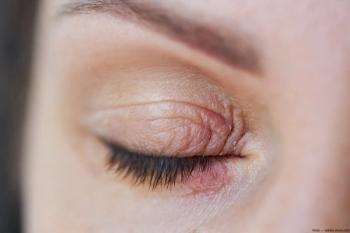 Closeup of closed eyelid Image credit: AdobeStock/oes