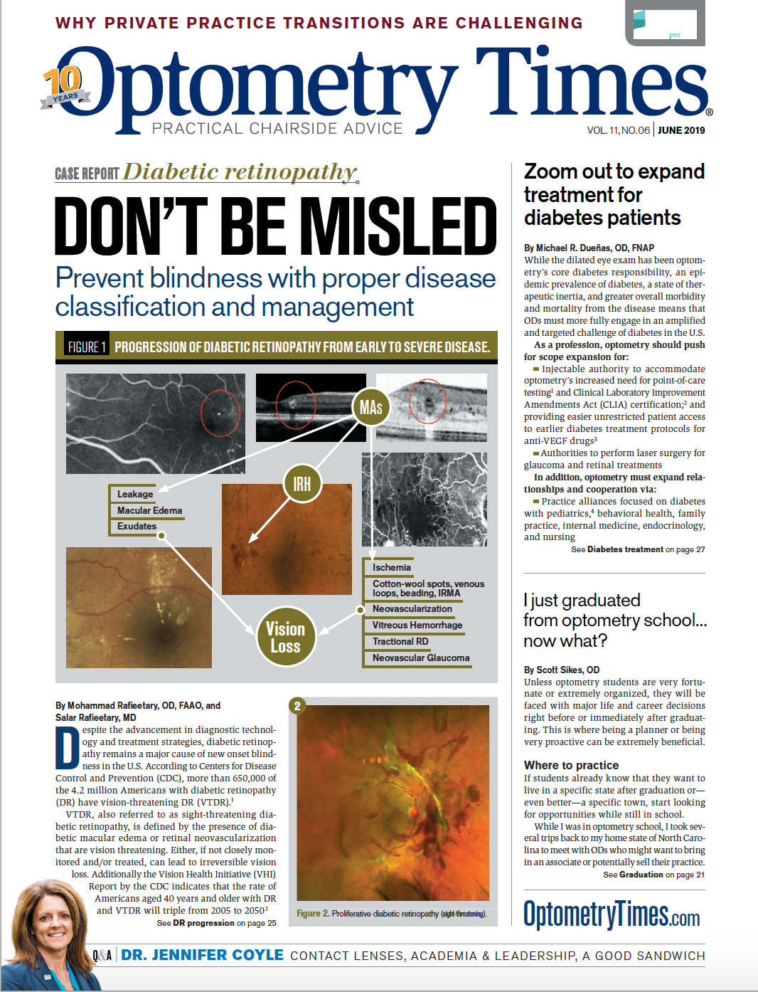 How artificial intelligence is changing the future of optometry