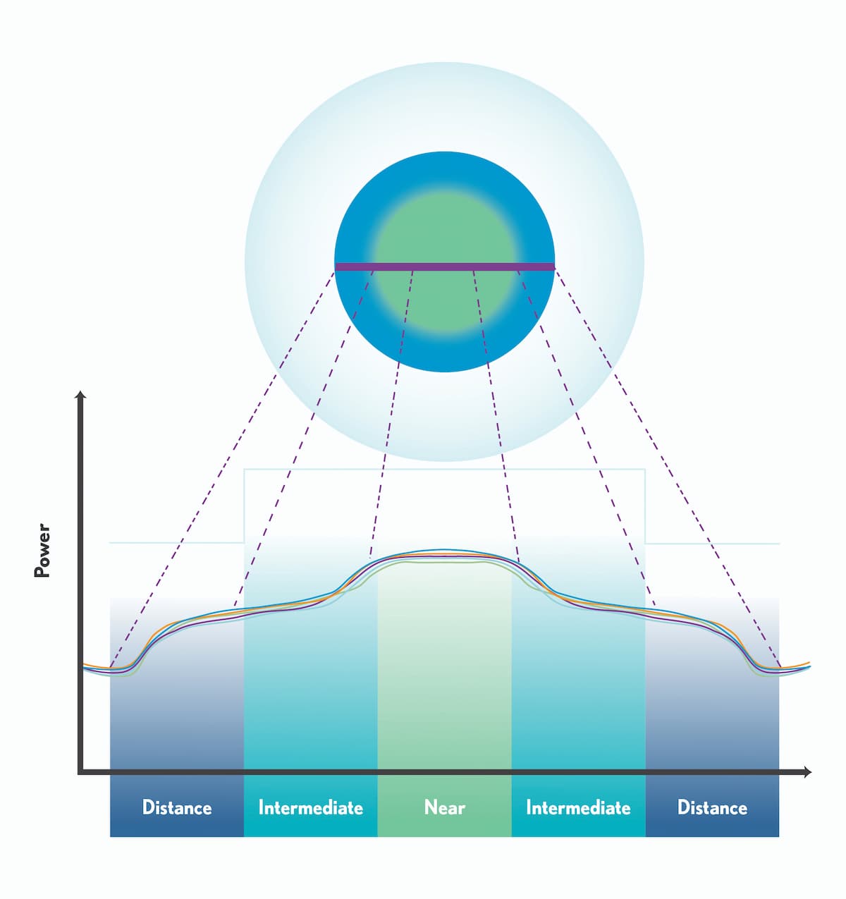 Multifocal contact lens optics optimize the patient experience