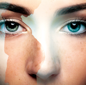 Effects of pregnancy on keratoconus