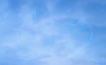 Sky with floaters in vision Image credit: AdobeStock/CoronaBorealis