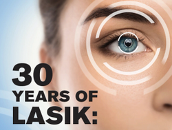 30 years of LASIK