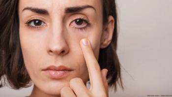 Woman with dry eyes pointing to her eye Image credit: ©My Ocean studio - adobe.stock.com