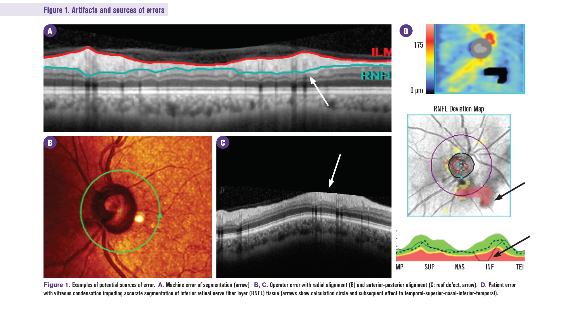 Why Doctors Are Rethinking Amd Standards