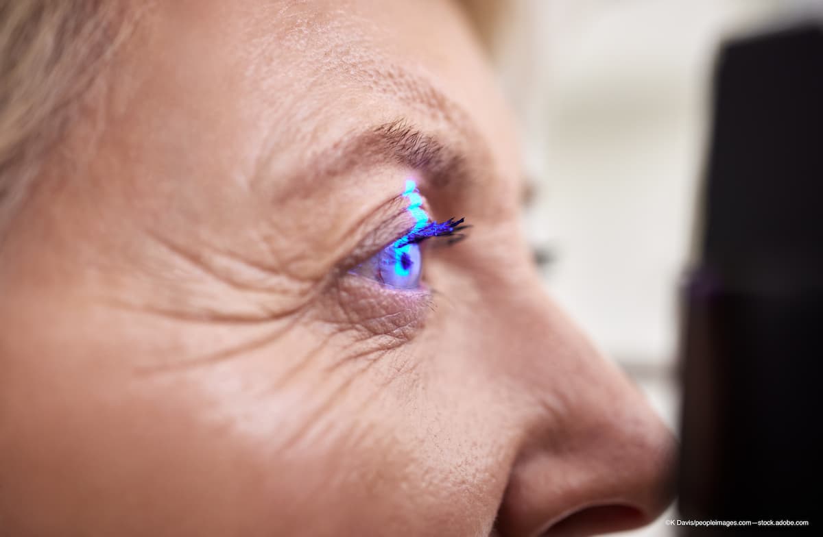 iRORA conversion found using fundus autofluorescence - Image credit: ©K Davis/peopleimages.com—stock.adobe.com