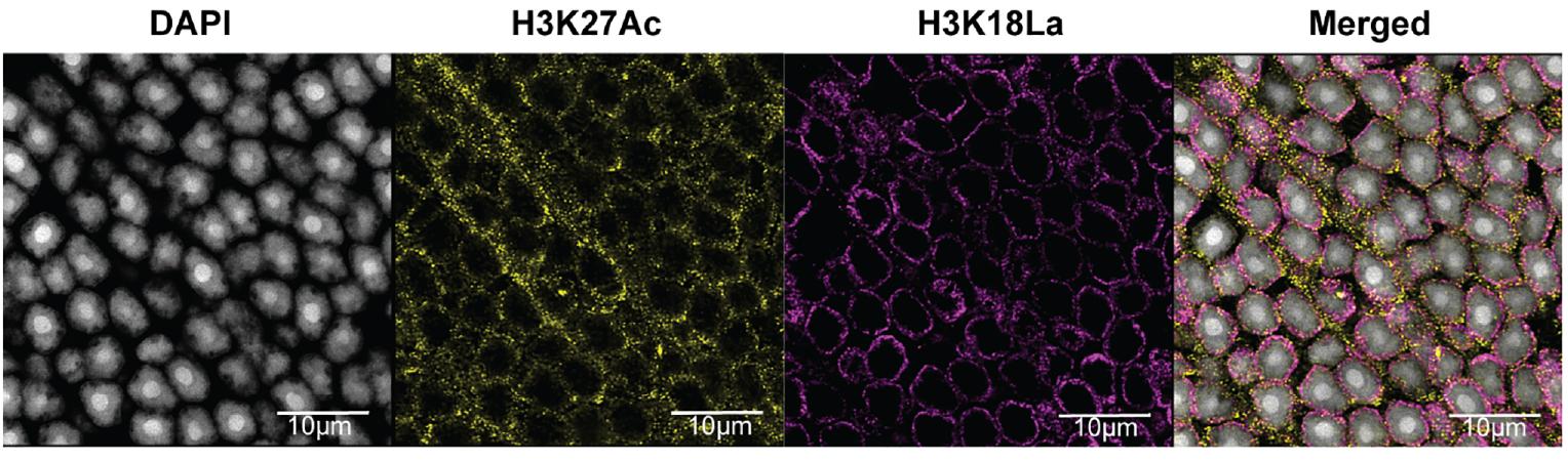 Per the NEI, “confocal immunofluorescent images show colocalization of H3K27Ac and H3K18La in the nuclear periphery of photoceptor cells.” Image credit: Anand Swaroop, PhD