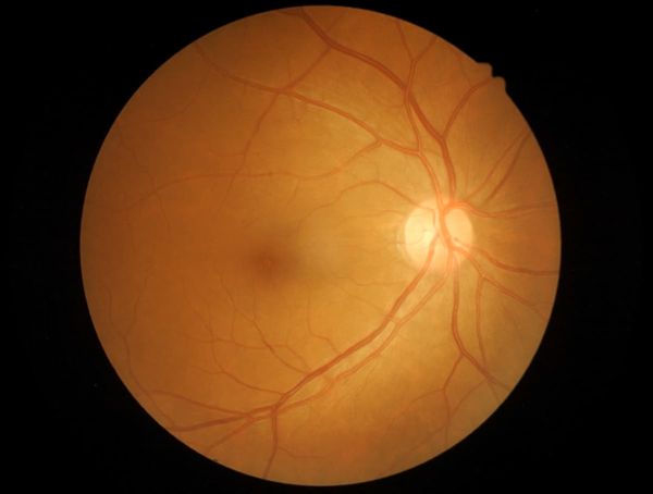 Image of retina Image credit: AdobeStock/memorisz