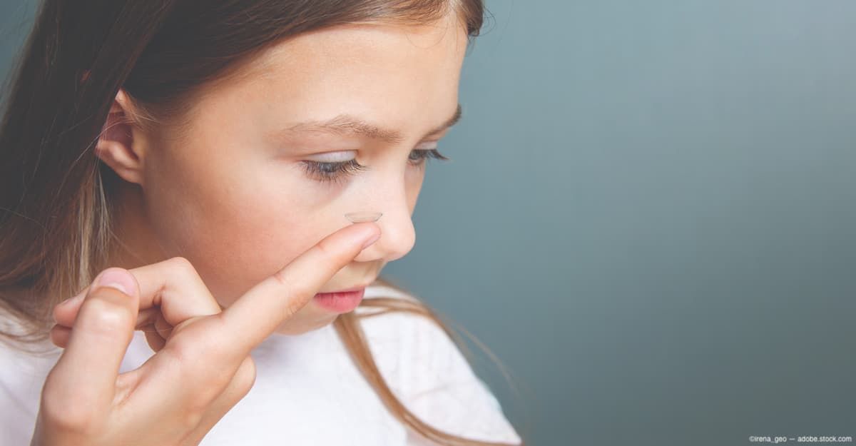 young girl inserting contact lens Image credit: ©irena_geo - adobe.stock.com