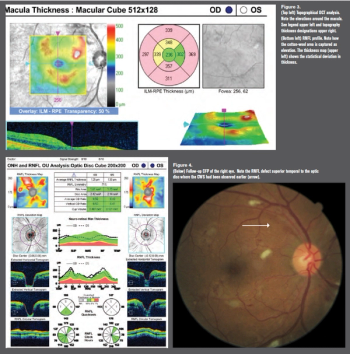 Retina Figure 3
