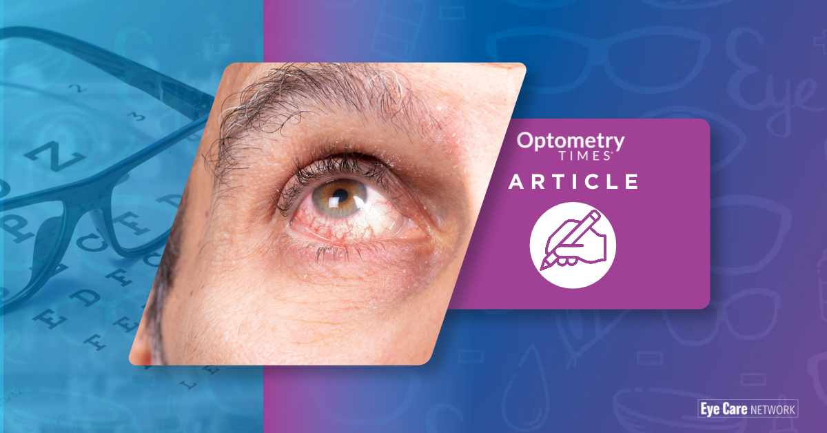 Man suffering from uveitis | Image Credit: Adobe Stock/Alessandro Grandini