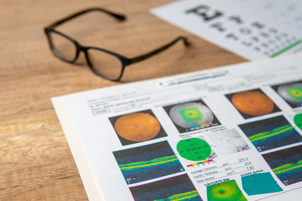 Norway first in world to deploy autonomous AI eye screening technology on national scale
