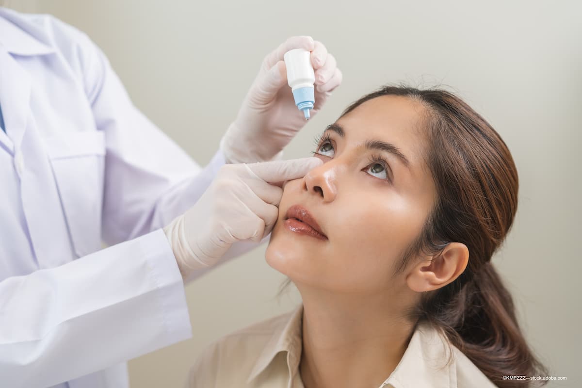 FDA approves Amneal formulation of prednisolone acetate ophthalmic solution 1% - Image credit: ©KMPZZZ—stock.adobe.com