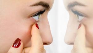 Effect of COVID-19 on vision correction habits 