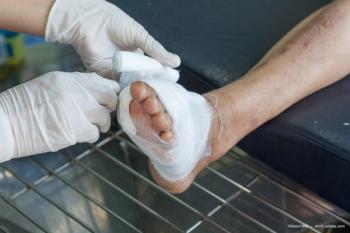 foot ulcer in diabetes patient 