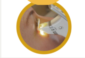 Systane iLux2 Meibomian Gland Dysfunction (MGD) Thermal Pulsation System 