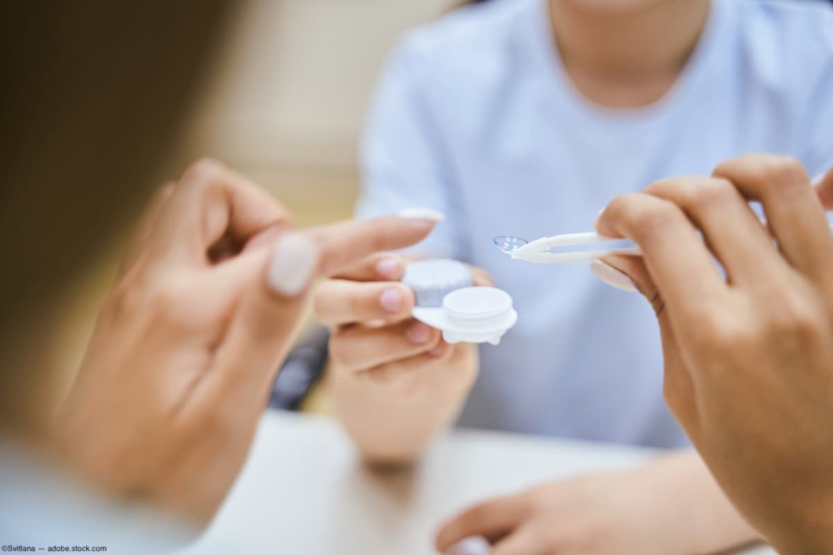 Contact lens being administered by physician Image credit: AdobeStock/Svitlana
