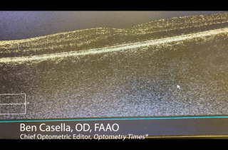 OCT is a dynamic test