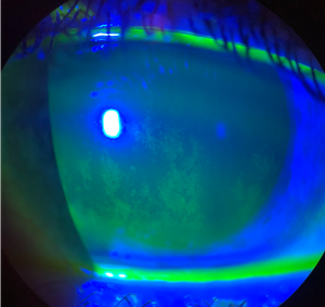 5 common ocular problems seen during the pandemic