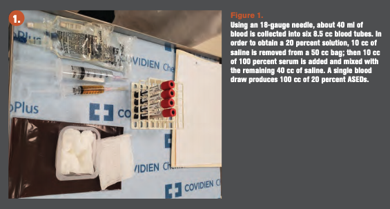 blood tubes sit next to saline on a table