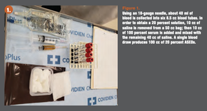 blood tubes sit next to saline on a table