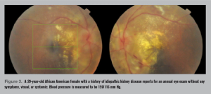 Retina scan images