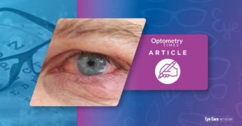 Closeup of irritated eye | Image credit: AdobeStock/MilosCirkovic