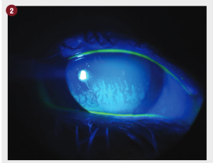 How to incorporate nutrition into dry eye practice 