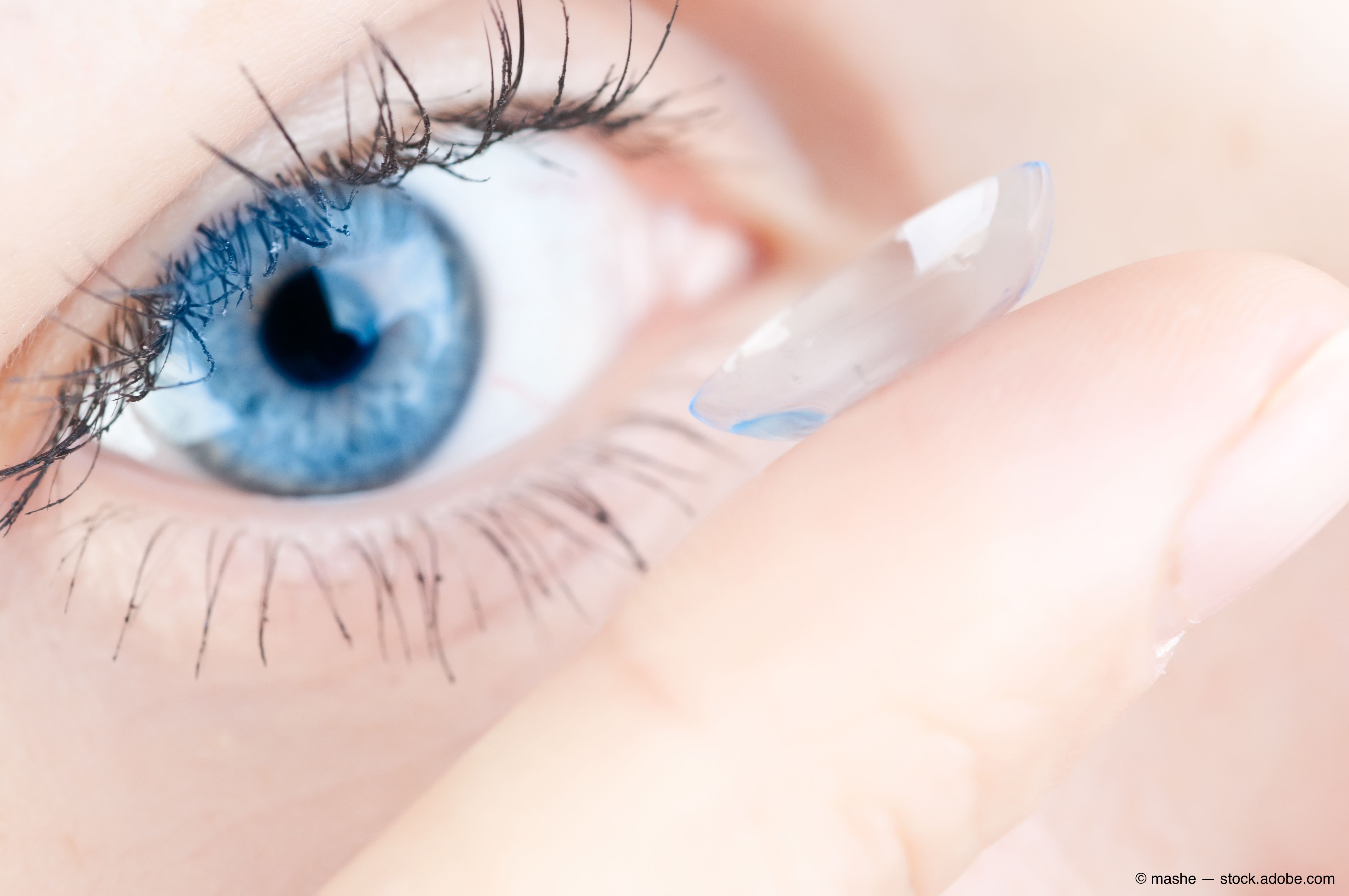 Research finds significant lack of contact lens knowledge in consumers