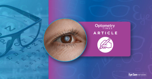 Cataract
