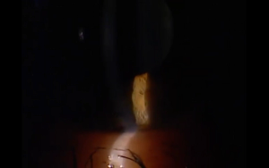 Think about the blink: Part 1