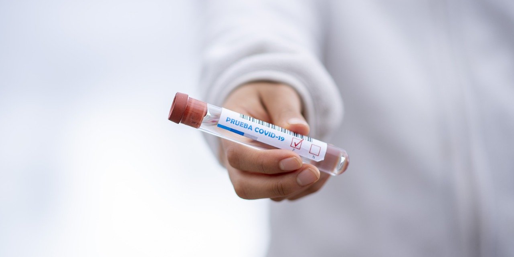 Covid 19 Antibodies Can Disappear In Non Symptomatic Individuals
