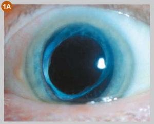 Technician plays key role in ophthalmic exam