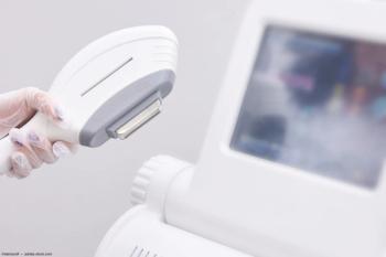 IPL machine Image credit: ©elenavolf - adobe.stock.com