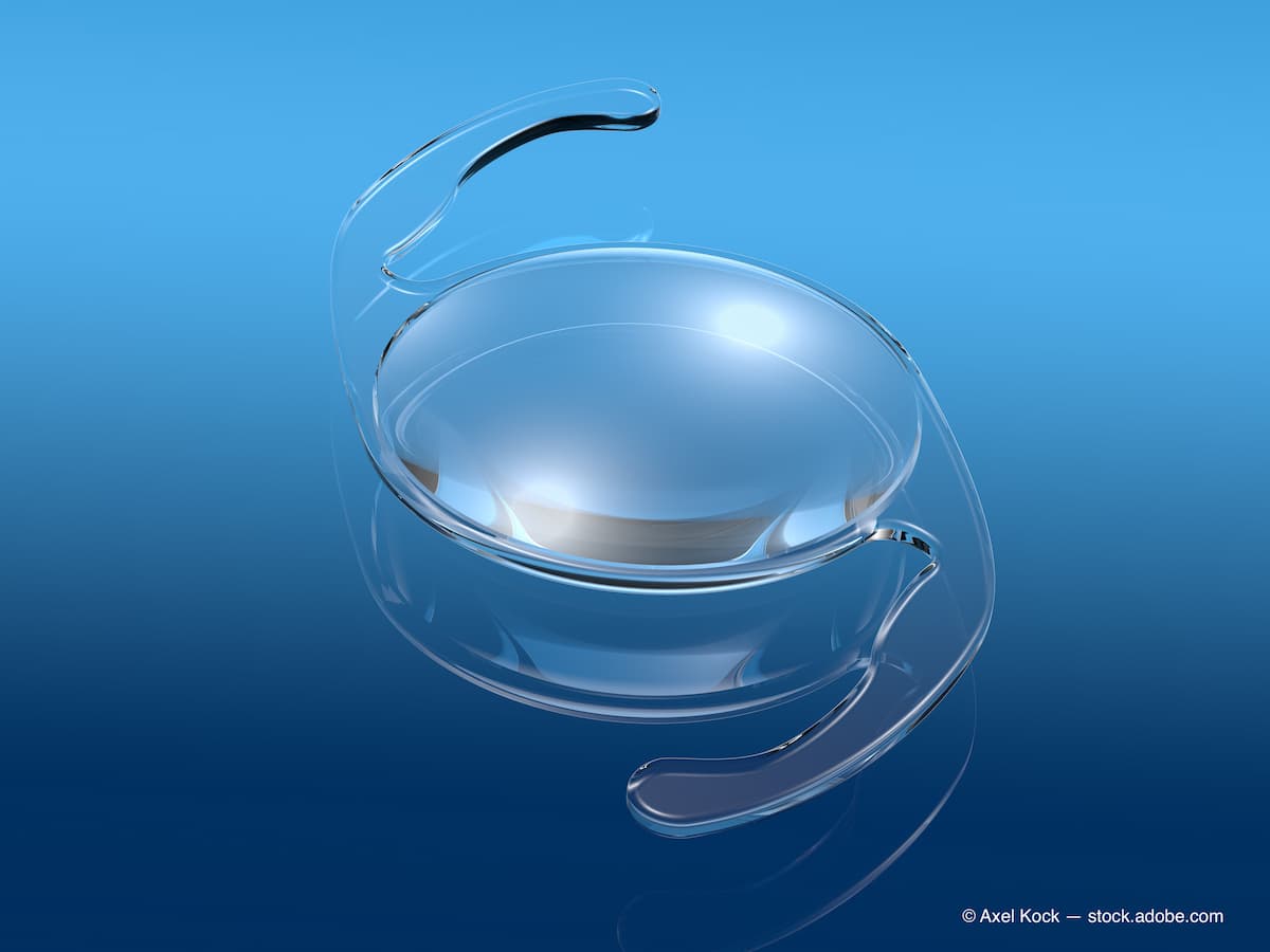 Instant Lens Optometry The optometrist plays an important role in premium intraocular lens ...
