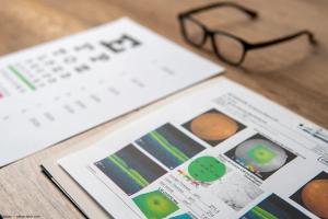 Visual field test and OCT images on table. Image credit: AdobeStock/izzuan