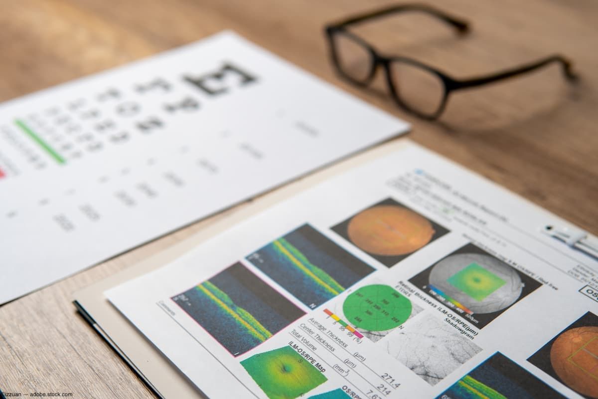 Oct Optometry Options Taking your OCT outside of the posterior pole