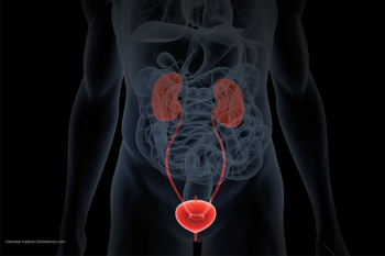 bladder x ray