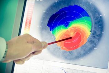 Doctor pointing to corneal topography Image credit: AdobeStock/Emiliano