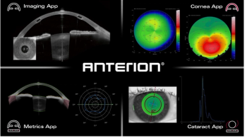 Heidelberg's FDA-approved apps for imaging, metrics, cornea and cataract care. Image courtesy of Heidelberg Engineering GmbH.