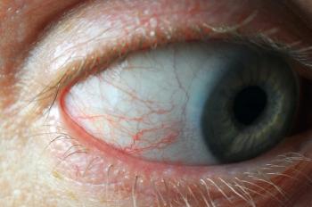 Closeup of eye with contact lens Image credit: AdobeStock/revers_jr