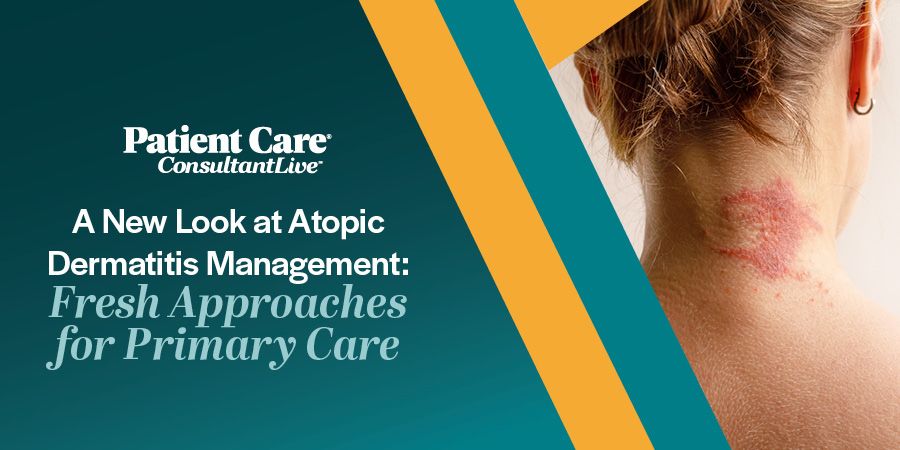 A New Look at Atopic Dermatitis Management: Fresh Approaches for Primary Care WATCH SERIES