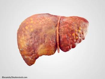 Hepatitis C, direct acting antiviral, HCV, Hep C