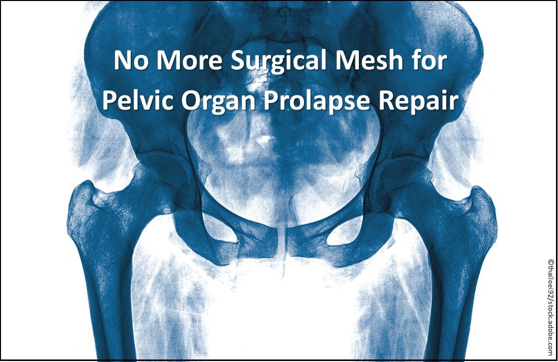 7 New Developments in Women's Health, surgical mesh, FDA, pelvic organ prolapse